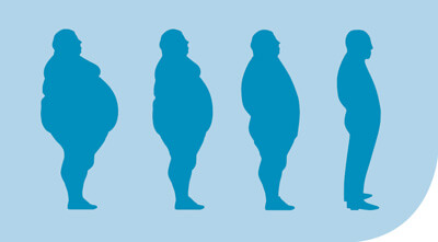 Identify which type of obesity you are.